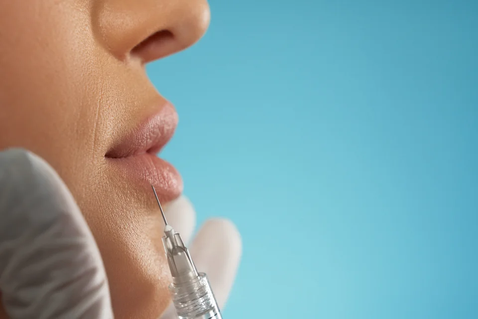 Rellenos dérmicos en Miami: RHA, Radiesse, Sculptra y EZ-Gel comparados