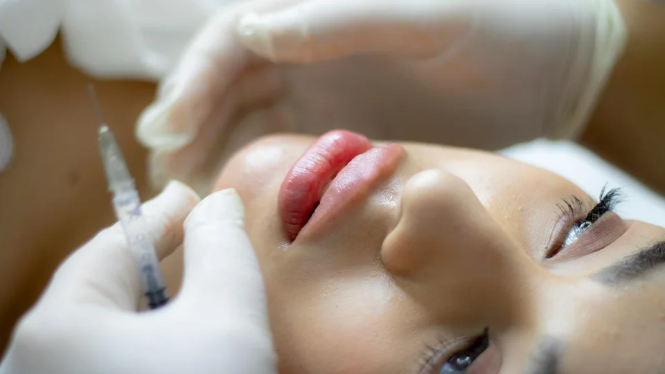Rellenos de labios en Miami: tu guía completa para resultados naturales