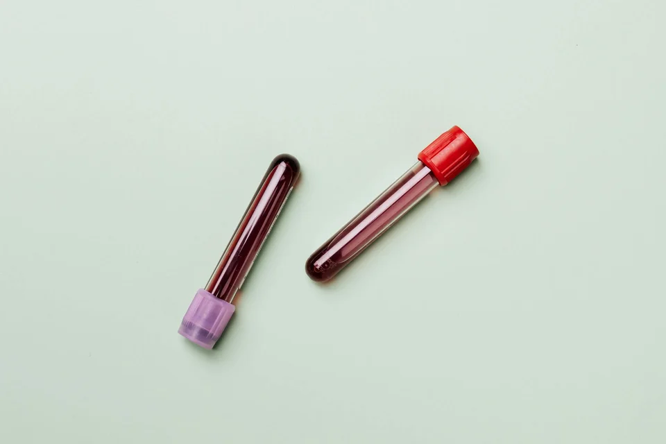 ¿Qué es la terapia PRP? Cómo tu propia sangre puede rejuvenecer tu piel y cabello